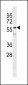 Vimentin Antibody
